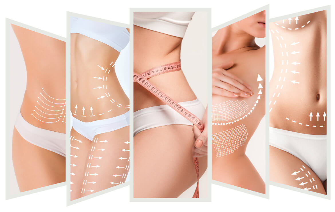 Vanquish Fat Removal: Noninvasive Radiofrequency Treatment